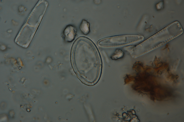 Cimitero di diatomee?